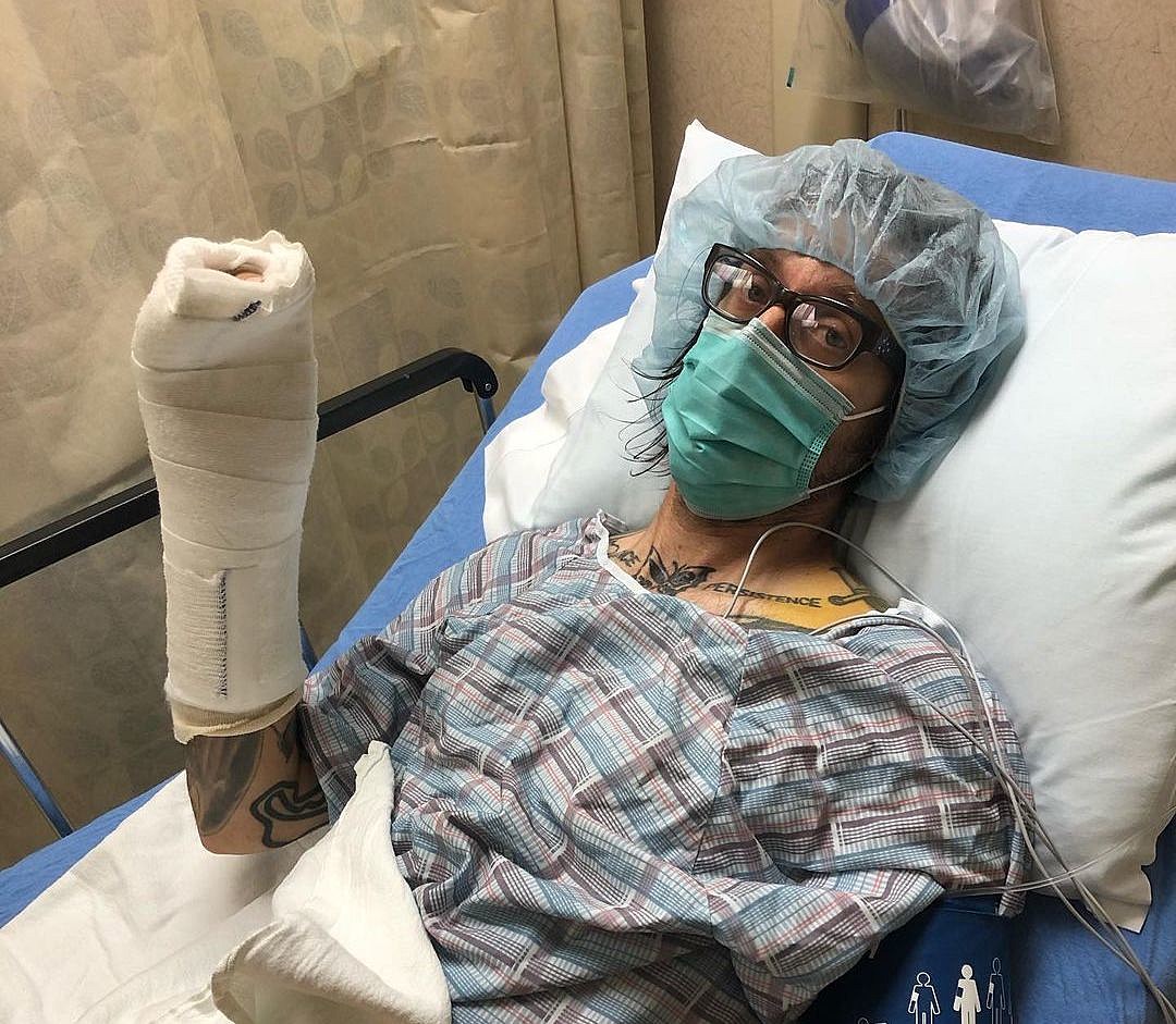 Atom Willard recovering from surgery after motorcycle crash