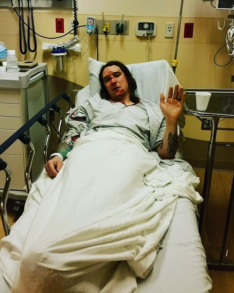 Deafheaven/Doomriders’ Chris Johnson injured in bike accident; crowdfunding campaign launched