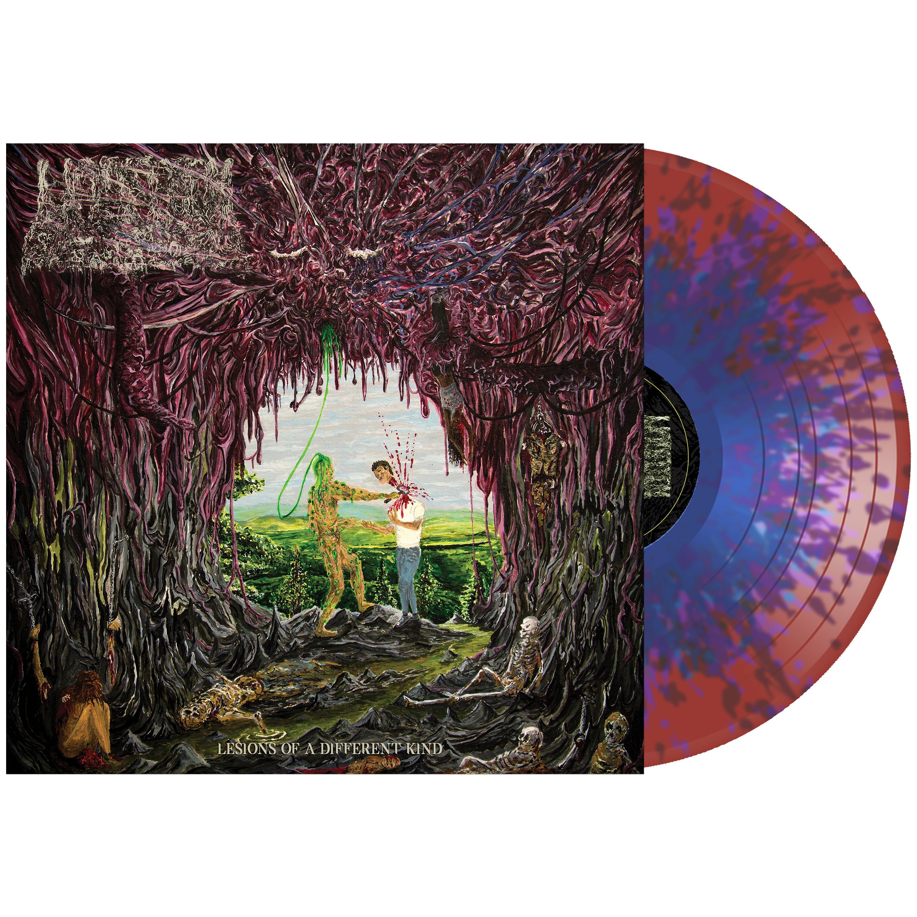 UNDEATH 'LESIONS OF A DIFFERENT KIND' LP (Multiple Color Variant Vinyl)