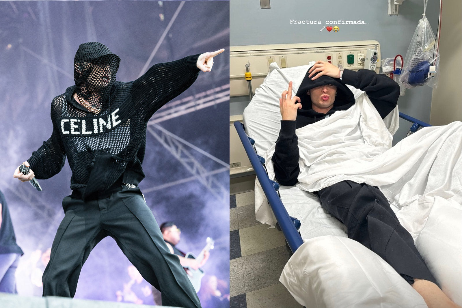 Peso Pluma fractured ankle on stage at GovBall, powered through his set anyway