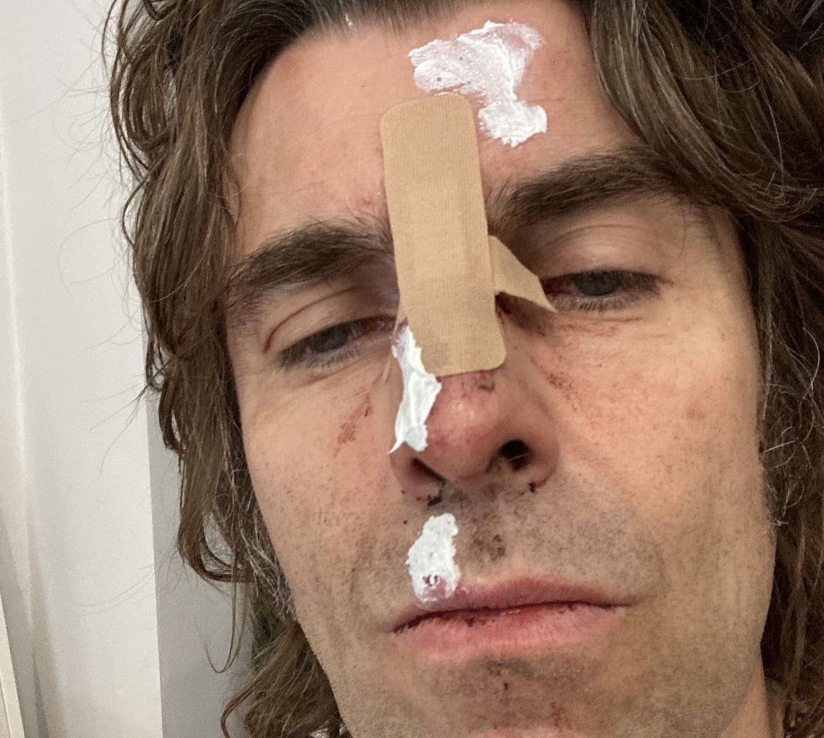 Liam Gallagher, whose 49th birthday is today, fell out of a helicopter (but is ok)