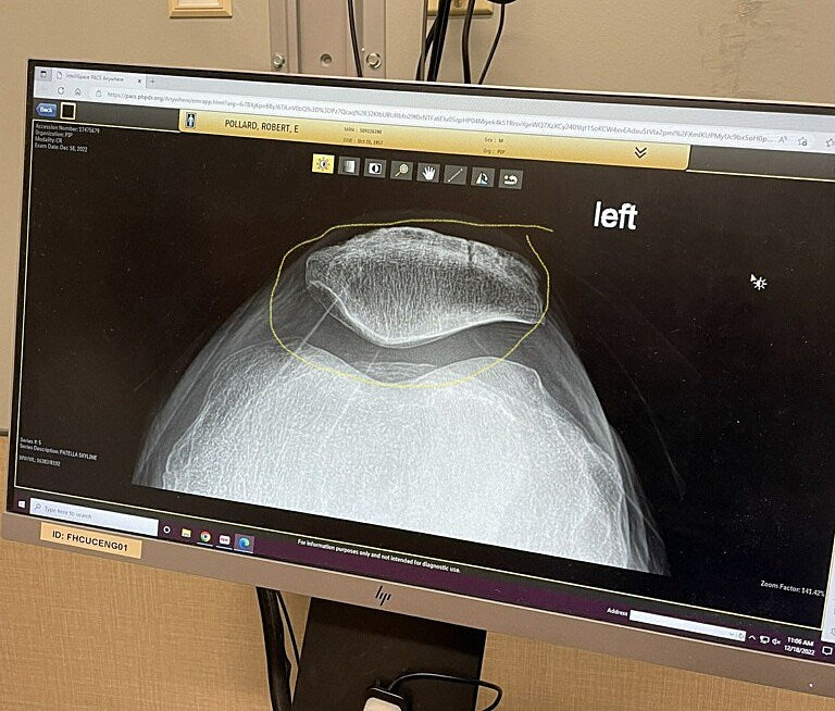 Robert Pollard fractured his knee; Guided by Voices’ New Years shows canceled