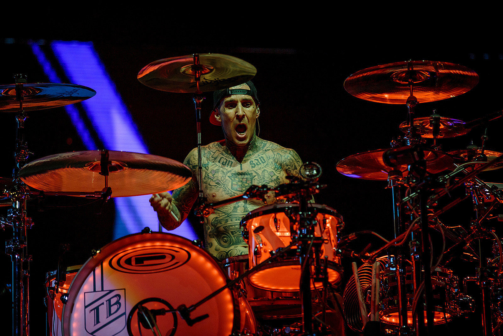 Travis Barker’s hospitalization reportedly due to pancreatitis