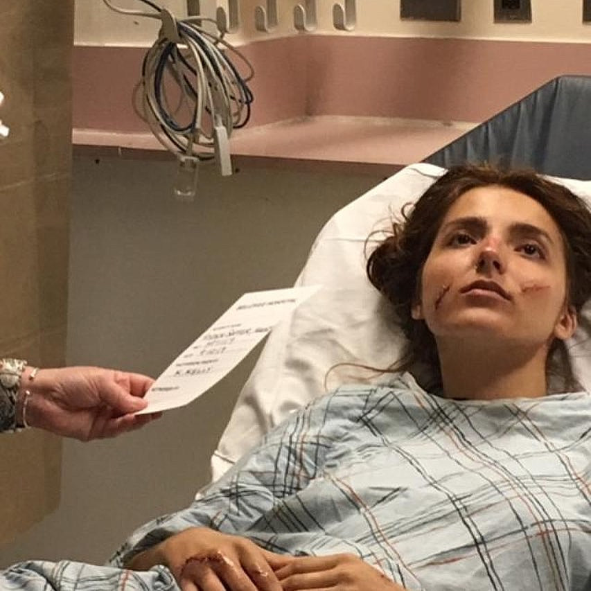 Haley from Sloppy Jane mugged in Brooklyn, needed 46 stitches