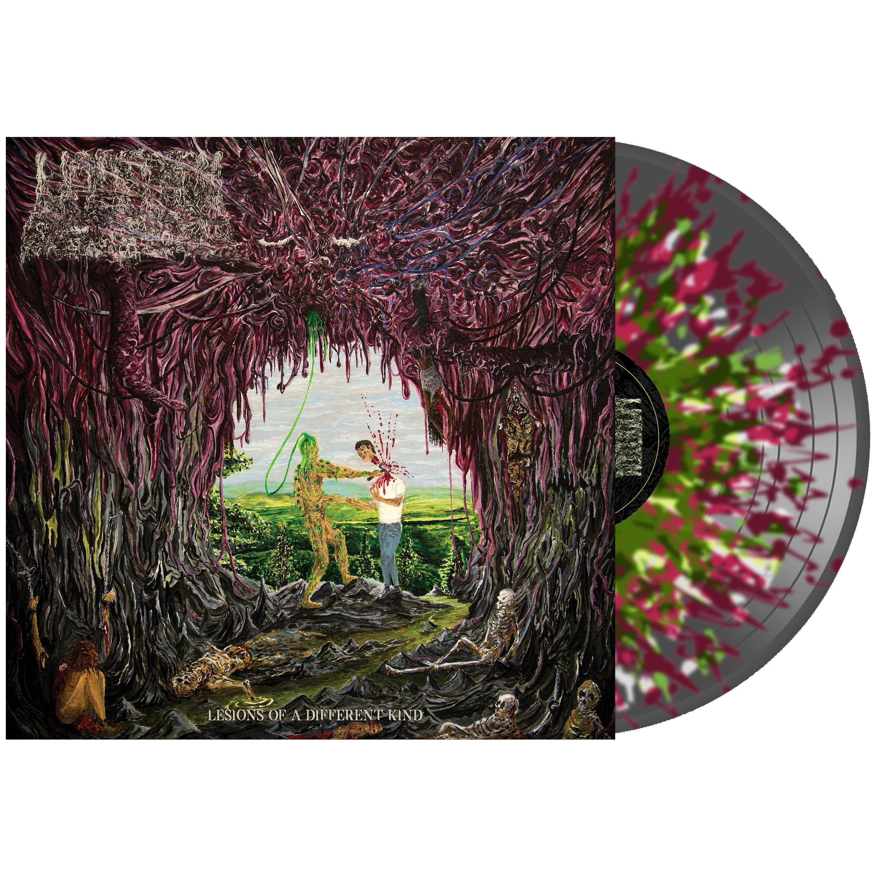 UNDEATH 'LESIONS OF A DIFFERENT KIND' LP (Multiple Color Variant Vinyl)