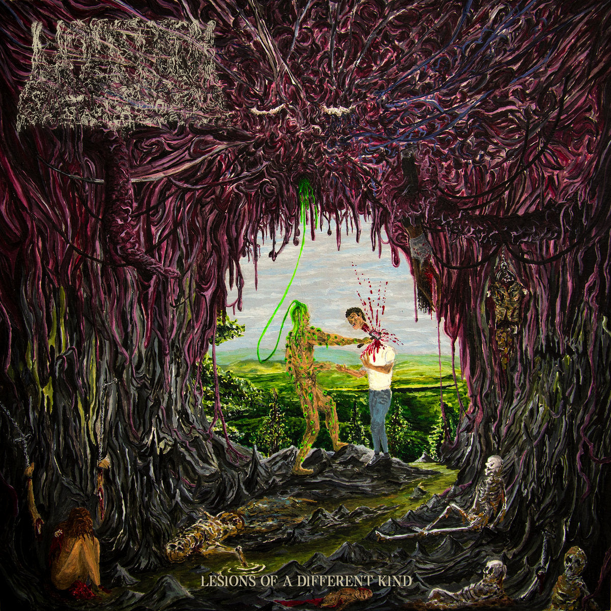 UNDEATH 'LESIONS OF A DIFFERENT KIND' CD