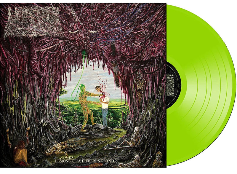 UNDEATH 'LESIONS OF A DIFFERENT KIND' LP (Green Vinyl)